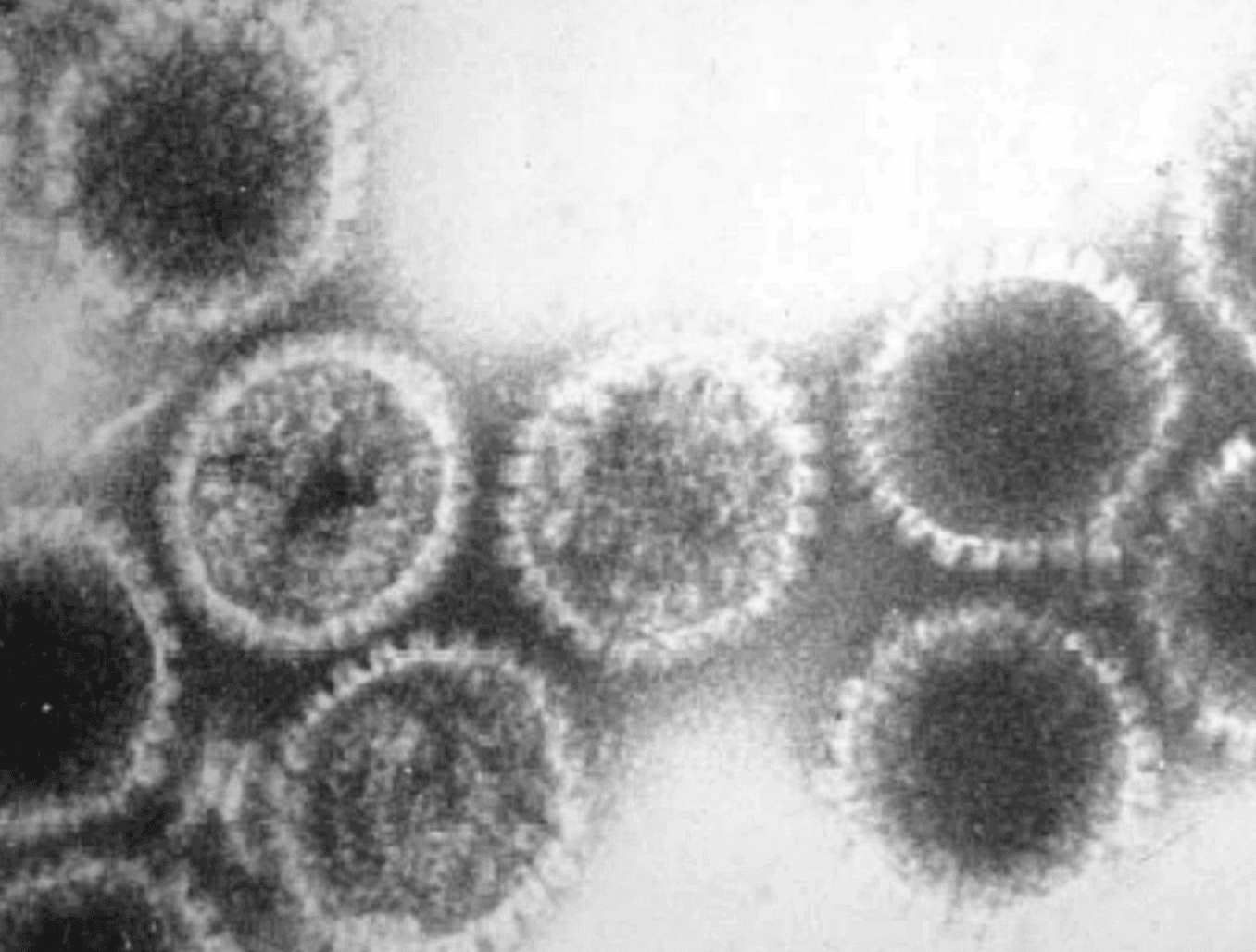 Electron microscopy showing enveloped viral particles with icosahedral nucleocapsids