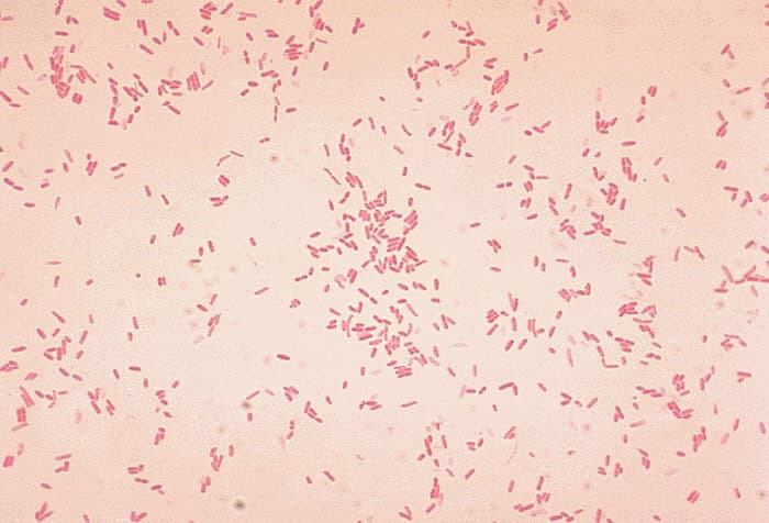 Gram stain demonstrating Aeromonas hydrophila as gram-negative rods