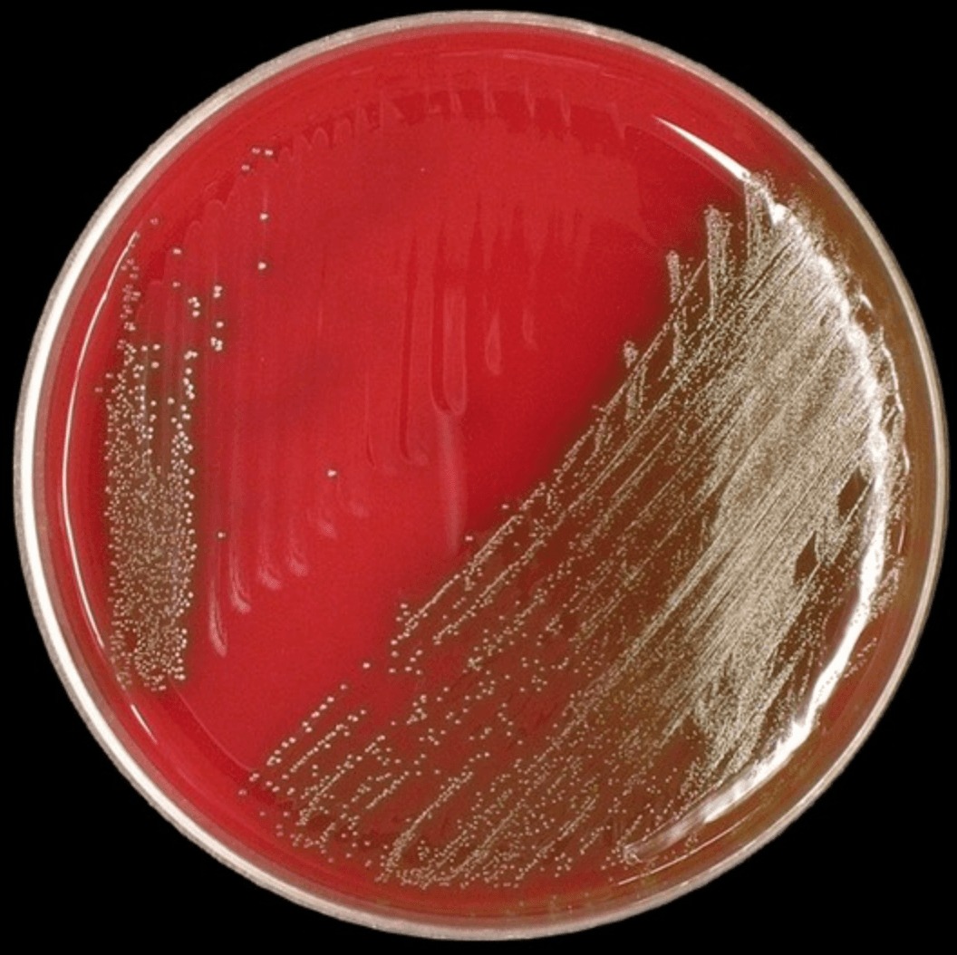 Blood agar plate showing pinpoint alpha-hemolytic colonies of Streptococcus anginosus group with characteristic narrow green halo