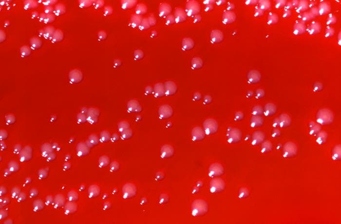 Blood agar plate showing Arcanobacterium haemolyticum colonies