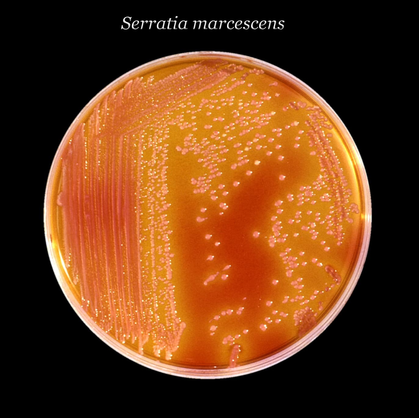 Serratia marcescens growing on XLD agar, showing characteristic red-pigmented colonies