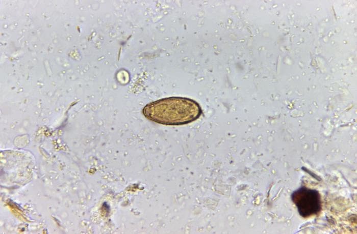 Microscopy of Clonorchis sinensis egg showing operculum and opercular shoulders