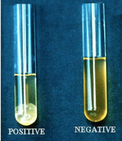 Coagulase tube test showing coagulase-negative staphylococcal isolate