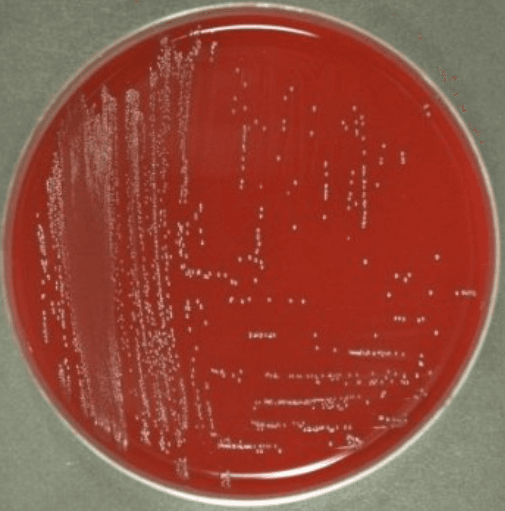 Culture plate from a positive clinical specimen showing small gray colonies