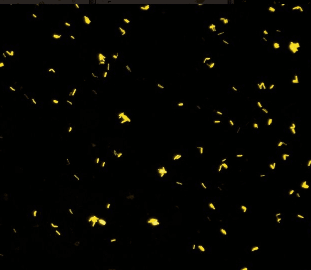 Auramine fluorescence stain of BACTEC blood culture broth showing acid-fast bacilli