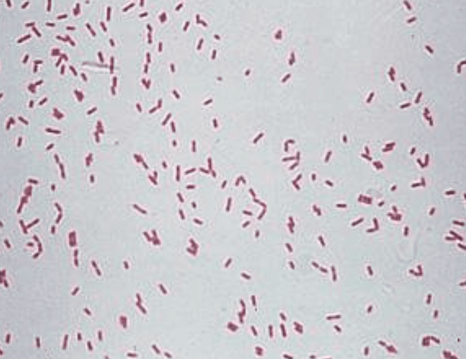 Gram stain showing gram-negative bacilli from a culture-positive specimen