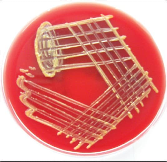 Blood agar culture after 48 hours demonstrating pigmented mucoid colonies