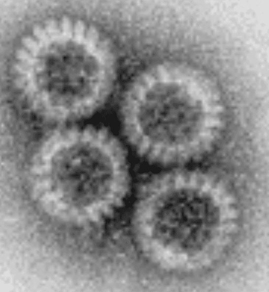 Electron micrograph of rotavirus particles showing classic wheel-like triple-layered capsid morphology