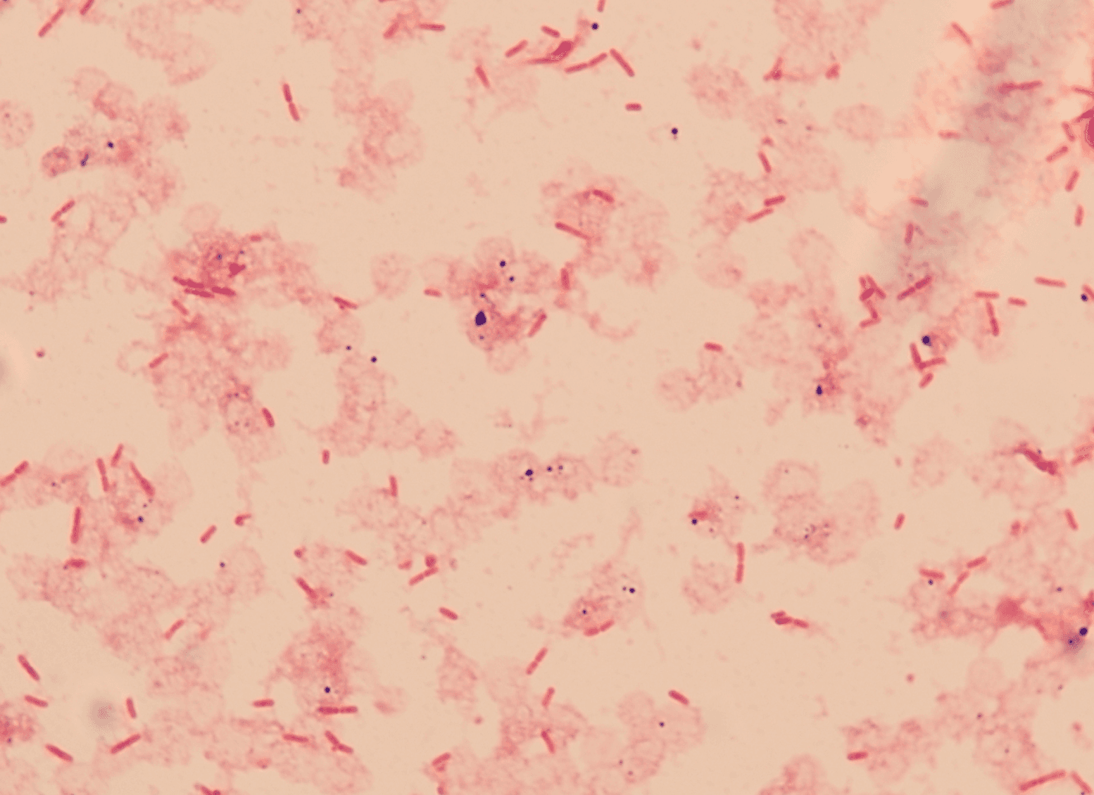 Gram stain from blood culture showing gram-negative rods