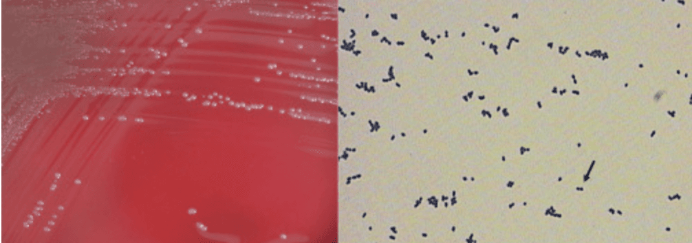 Sheep blood agar plate demonstrating growth from positive blood culture bottles