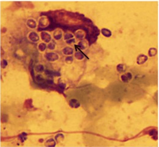 Talaromyces marneffei yeast forms with transverse septa