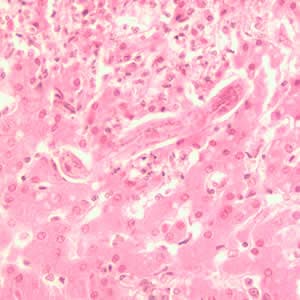 Hematoxylin and eosin stain showing a Toxocara larva in longitudinal section within hepatic parenchyma