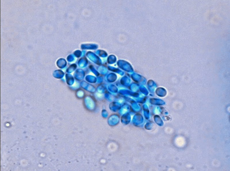 Trichosporon asahii on Sabouraud dextrose agar showing white cerebriform colony with yeast forms and arthroconidia