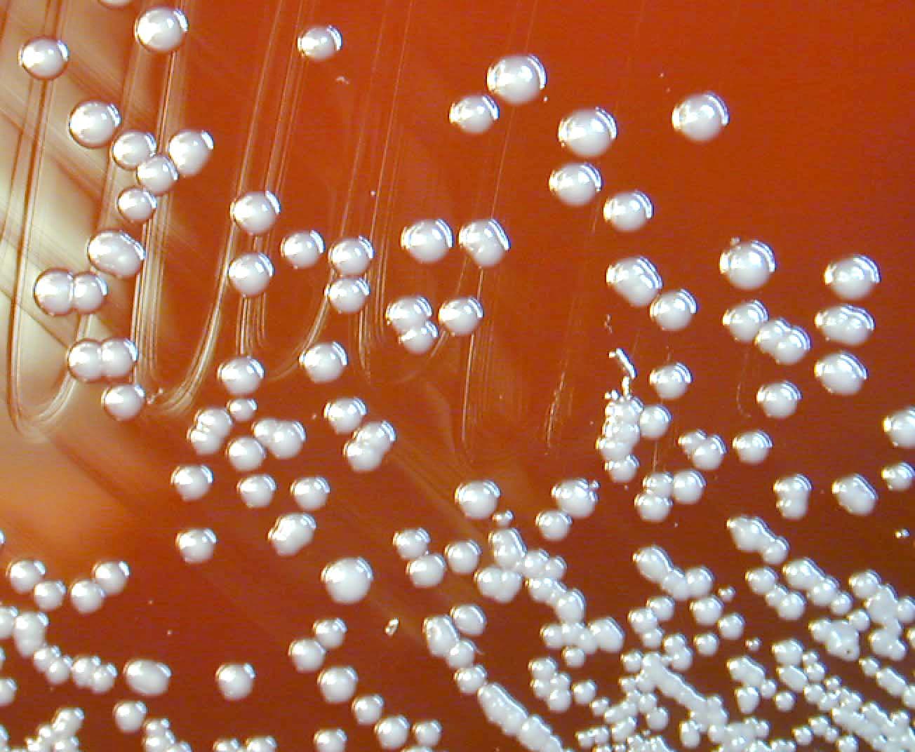 Burkholderia pseudomallei colonies on a blood agar plate, showing the characteristic wrinkled morphology.