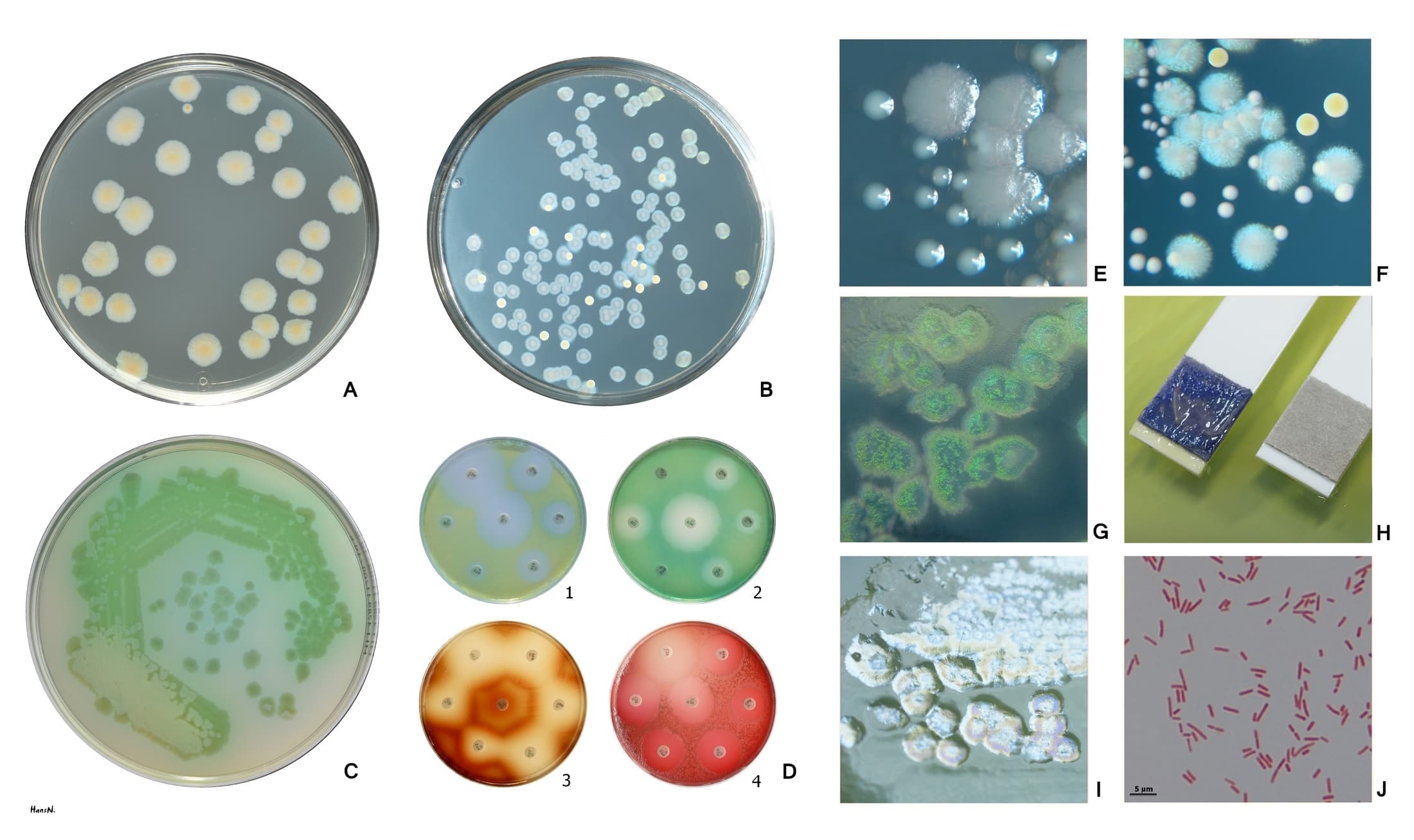Pseudomonas aeruginosa colonies on agar showing the characteristic blue-green pigment. The pigment is produced by pyocyanin (blue) and pyoverdin (yellow-green), which combine to create the color that gave the species its name: aeruginosa, Latin for verdigris.
