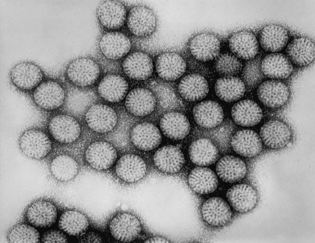 Transmission electron micrograph of rotavirus particles showing the characteristic wheel-like appearance.