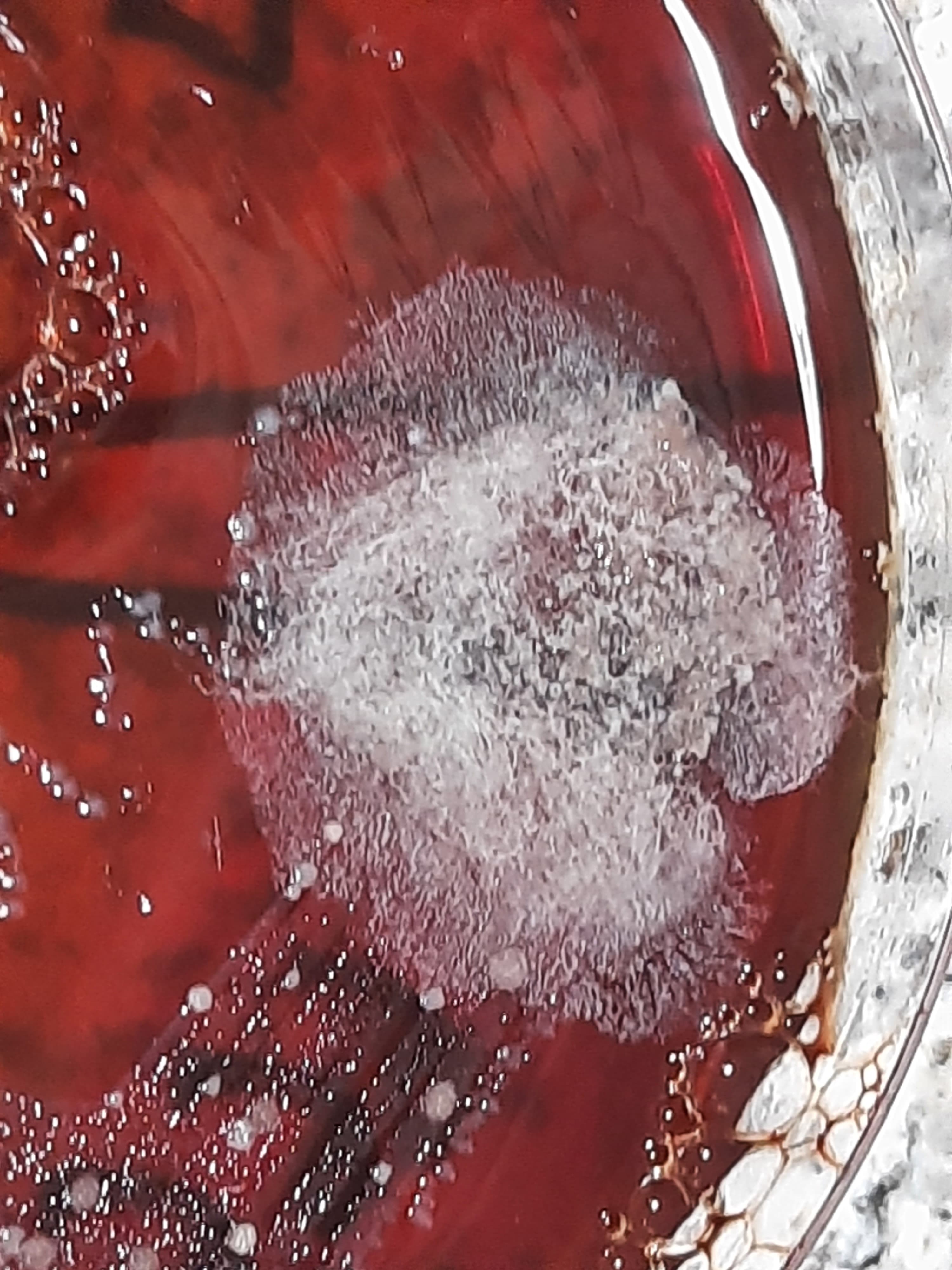Gray-white fluffy colonies of Mucor growing on a blood agar plate in a microbiology laboratory. These 'lid-lifter' colonies are a common contaminant but can also signal invasive mucormycosis when isolated from sterile sites.