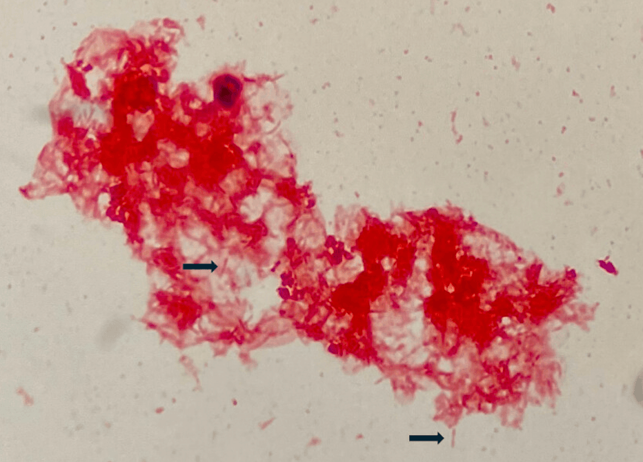 Gram stain showing slender elongated fusiform gram-negative rods with tapered ends characteristic of Capnocytophaga canimorsus