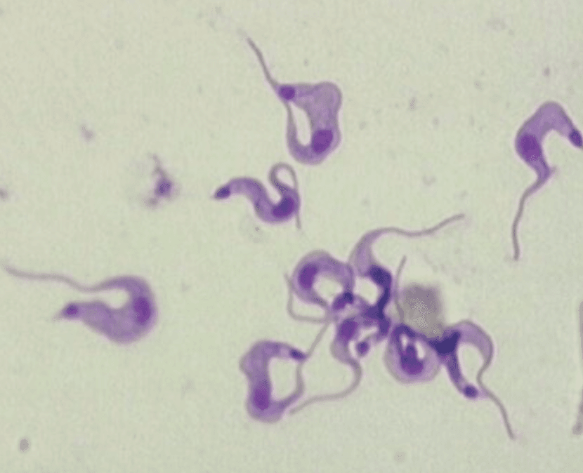 CSF wet mount showing a mobile flagellated trypomastigote consistent with Trypanosoma cruzi