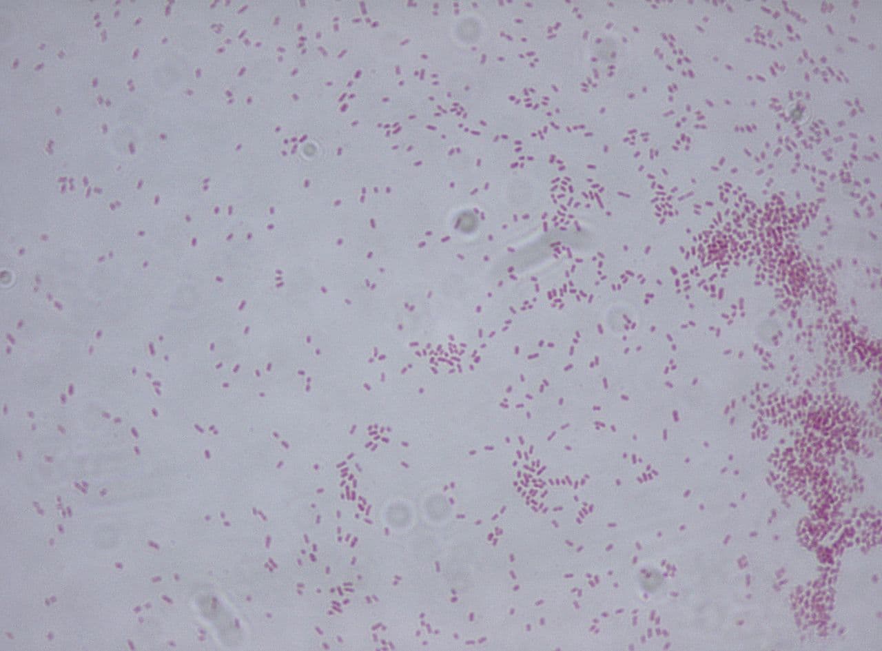 Gram stain of Klebsiella aerogenes demonstrating gram-negative bacilli