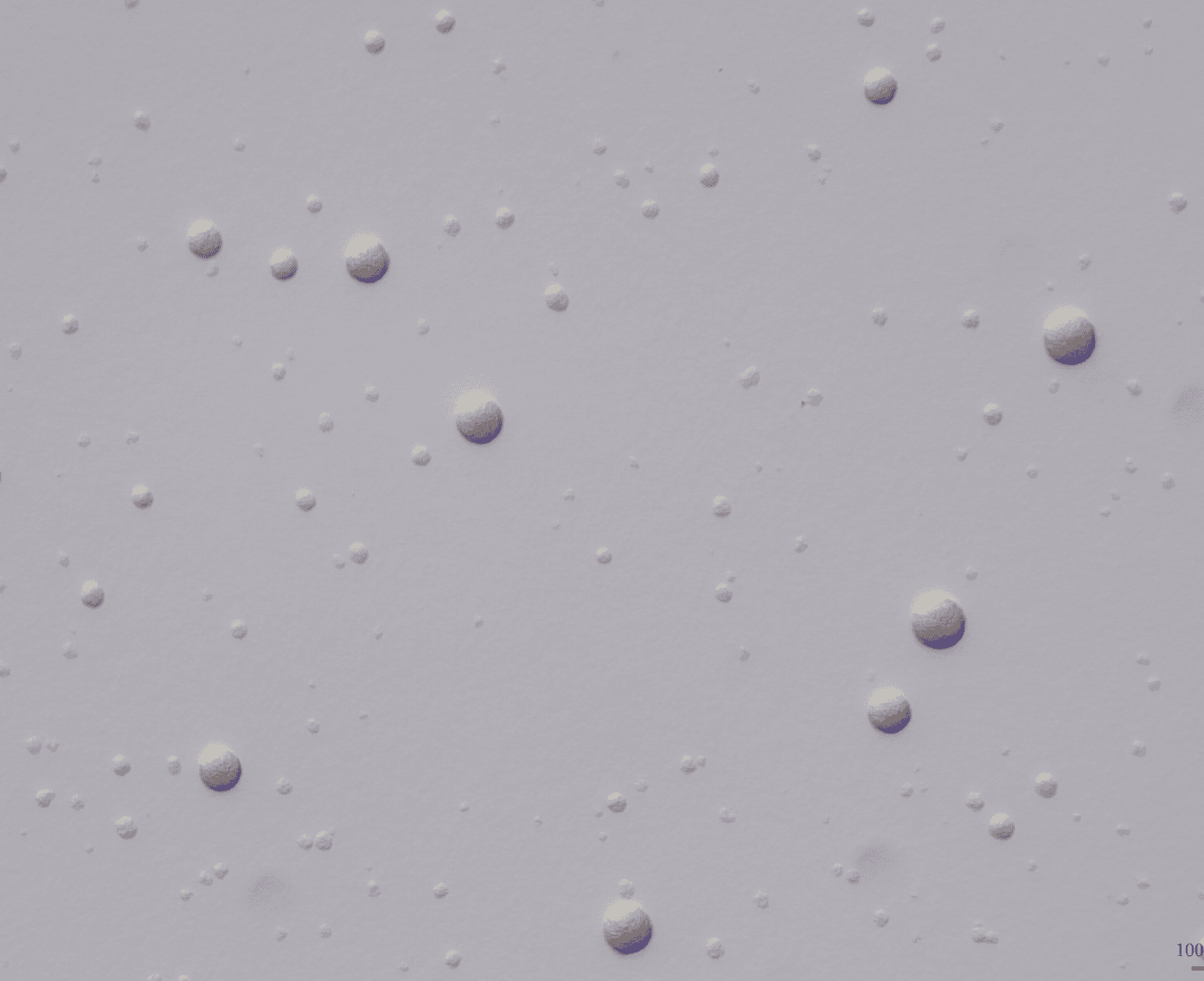 Mycoplasma genitalium colonies on SP4 agar demonstrating the characteristic granular morphology visible after extended incubation