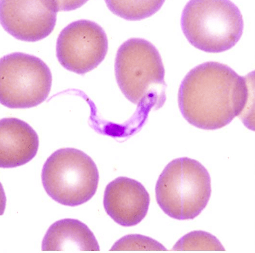 Peripheral blood smear showing trypomastigotes among red blood cells