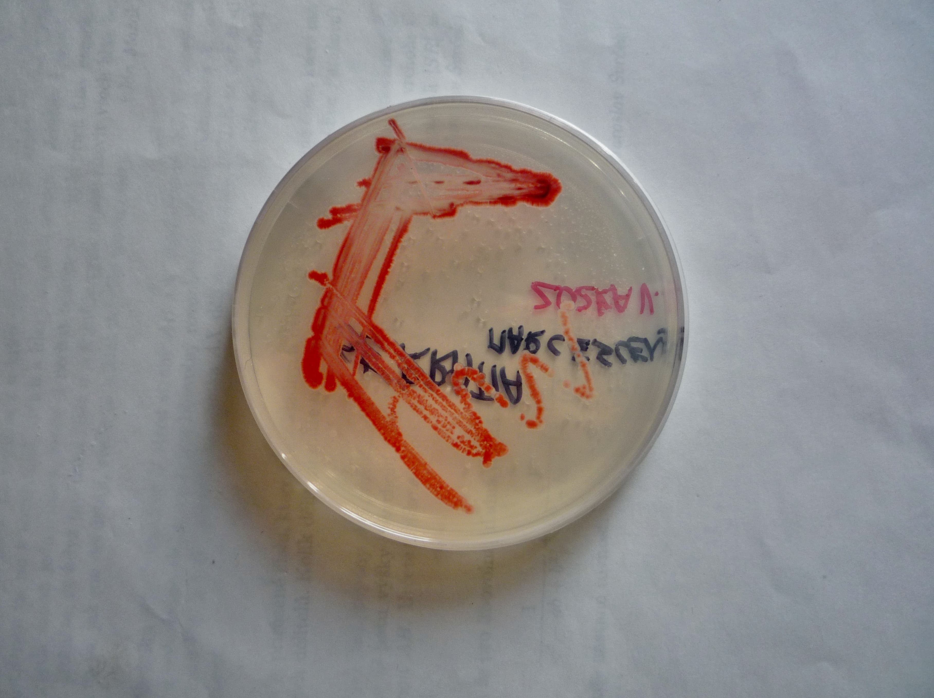 Bright red colonies of Serratia marcescens growing on an agar plate. The red pigment prodigiosin is what made the bacterium useful for tracking the spread of the 1950 biological warfare test.